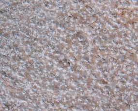 Bocciardatura